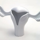 Image for article titled Doctors Debate What To Remove During Hysterectomies